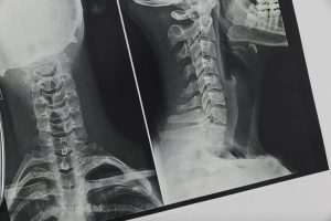 X-ray of human neck